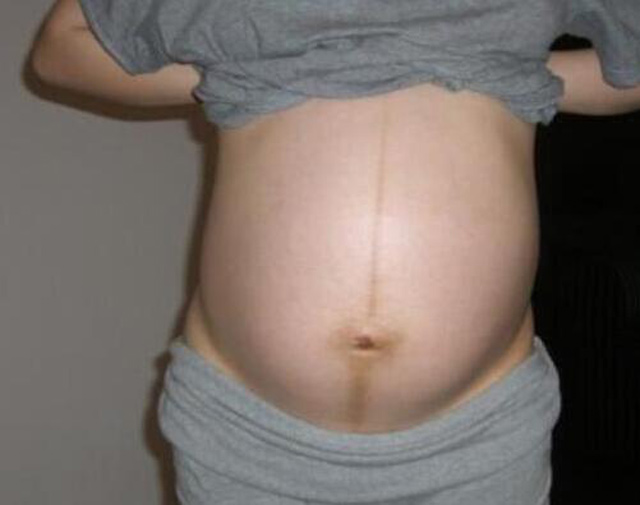 安陽(yáng)月子中心