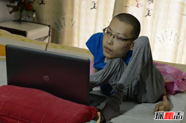 漸凍癥會(huì )遺傳下一代嗎?漸凍人最典型的十大癥狀