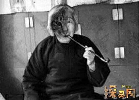哈爾濱貓臉老太太事件