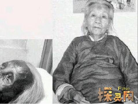 哈爾濱貓臉老太太事件